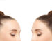 hairloss_mydreamsalon